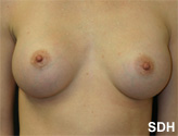 Patient # 56886 After Photo # 2